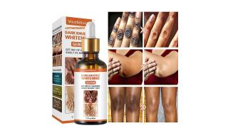 Dark Knuckle Whitening Serum In Koure Town in Niger Call +27710732372